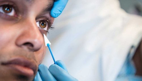 Doctor pointing to eye that has results of dry eye treatment